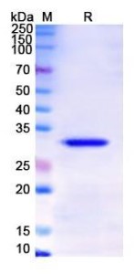 SDS PAGE (TPSB2-6279H).jpg